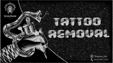 Tattoo_Removal